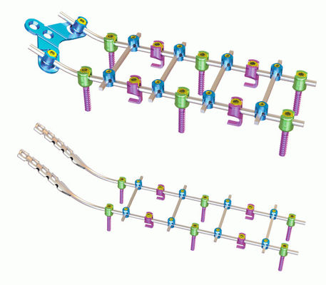チタニウムのOrthopedicsの後部の頚部固定システム
