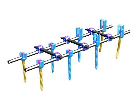Orthopedicsの背骨の内部固定のⅣ背骨の固定システム