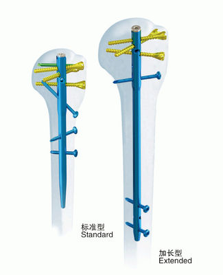 外科Orthopedicsの解剖上腕骨の連結の釘