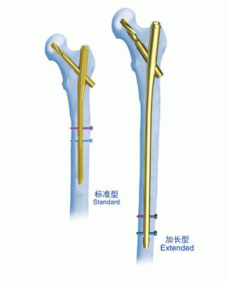 PFNAのセリウムのガンマの釘の固定の連結の釘
