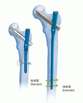 Orthopedicsのチタニウムのガンマの連結の釘ⅣPFN