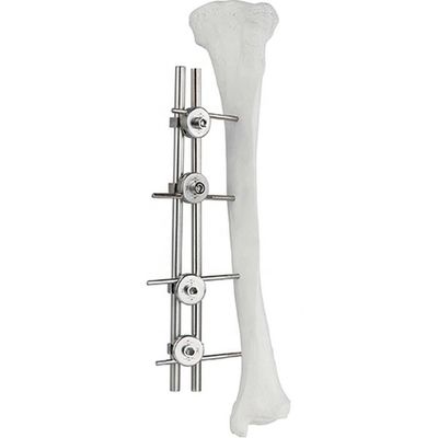 整形外科のインプラント腿骨のTibial外的なFixatorの骨の外科Fixator