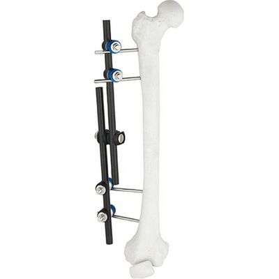 Tibial熱い販売の整形外科の外科手術用の器具及び腿骨の外面のFixator AOの外的な固定の整形外科の器械