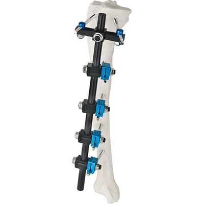 工場価格の整形外科の外科手術用の器具のTibial外的なFixator AOの外的な固定の整形外科のインプラント