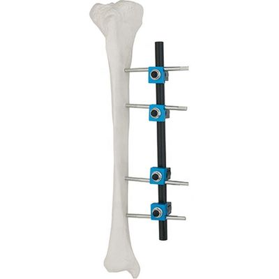 プロダクト	REF	指定	Qty.Condylar外的なFixator 8100-06	8100-0601	Ø8/8mmをつなぐ棒棒	3 8100-0602	PinR