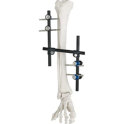 プロダクト	REF	指定	Qty.Condylar外的なFixator 8100-06	8100-0601	Ø8/8mmをつなぐ棒棒	3 8100-0602	PinR