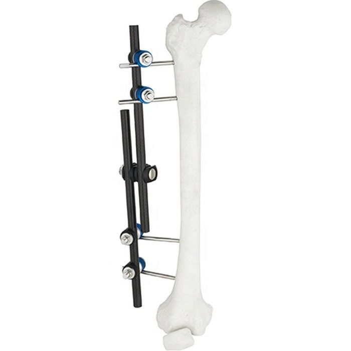 Tibial熱い販売の整形外科の外科手術用の器具及び腿骨の外面のFixator AOの外的な固定の整形外科の器械